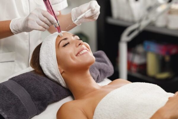 Microneedling